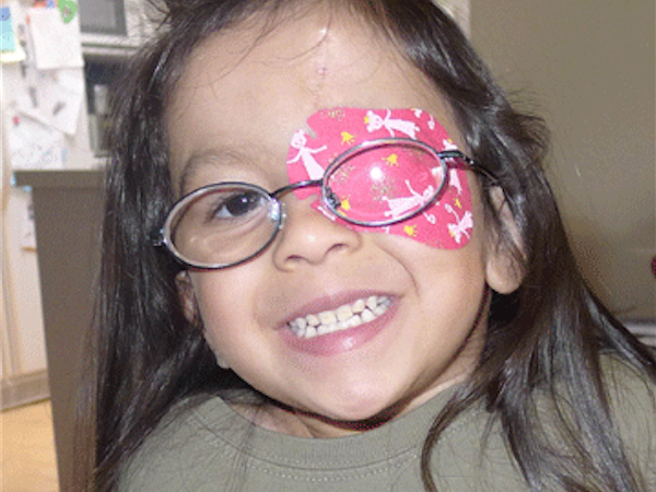 trattare occhio pigro con bendaggio