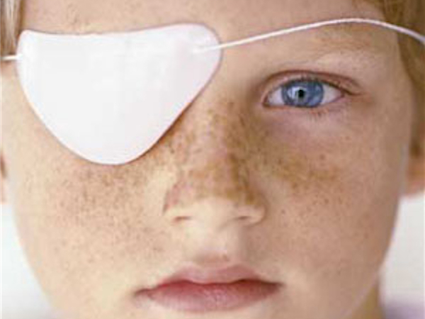 ambliopia o occhio pigro