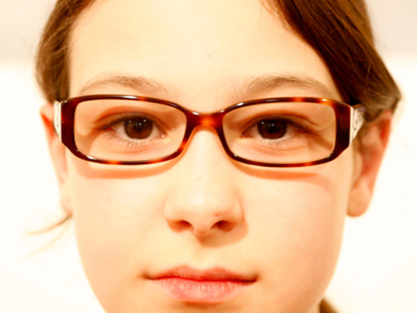 i difetti rifrattivi nei bambini