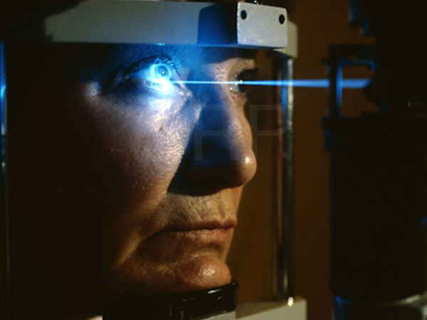 trattamento laser PDT nella degenerazione maculare