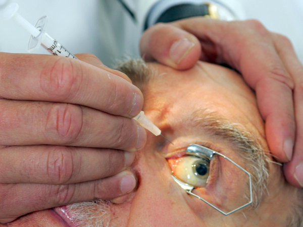 iniezione intravitreale di antiVEGF in retinopatia diabetica